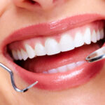 Enhancing Your Smile: Exploring Cosmetic Dentistry Options in Grand Rapids